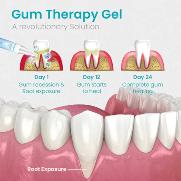 Gum Therapy Gel