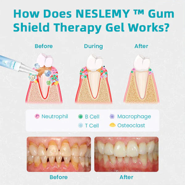 Gum Therapy Gel